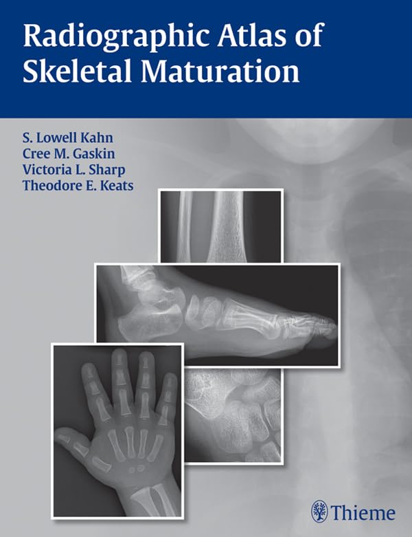 Radiographic Atlas of Skeletal Maturation 1st Edition