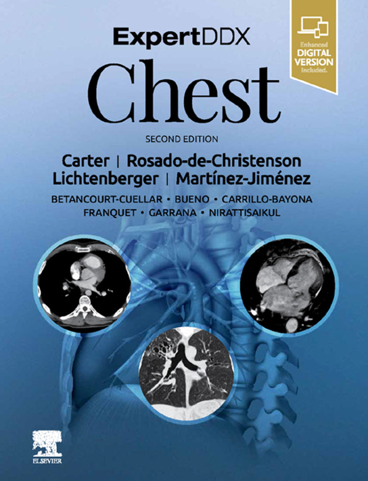 ExpertDDx: Chest 2nd Edition