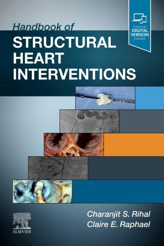 Handbook of Structural Heart Interventions