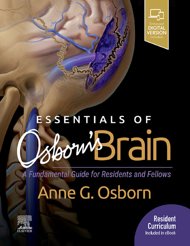 Essentials of Osborn's Brain: A Fundamental Guide for Residents and Fellows