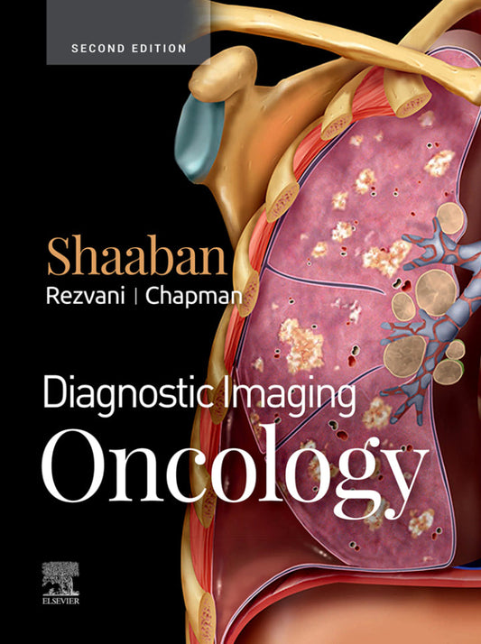 Diagnostic Imaging: Oncology 2nd Edition