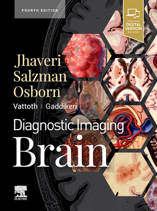 Diagnostic Imaging: Brain 4th Edition