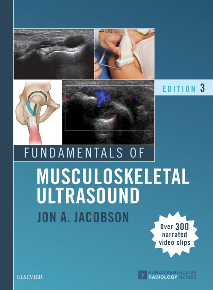 Fundamentals of Musculoskeletal Ultrasound 3rd Edition