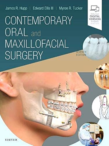 Contemporary Oral and Maxillofacial Surgery 7th Edition