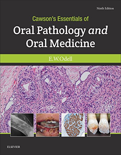 Cawson's Essentials of Oral Pathology and Oral Medicine 9th Edition